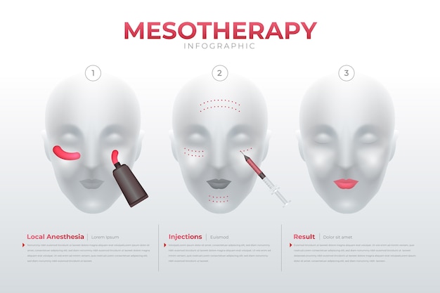 Kostenloser Vektor infografik zur gradienten-mesotherapie