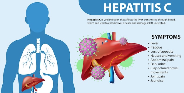 Kostenloser Vektor informative symptome von hepatitis c