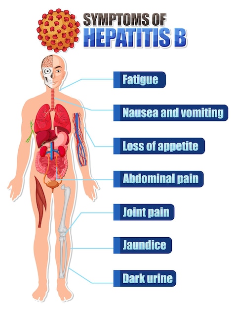 Kostenloser Vektor informatives poster mit häufigen symptomen von hepatitis b