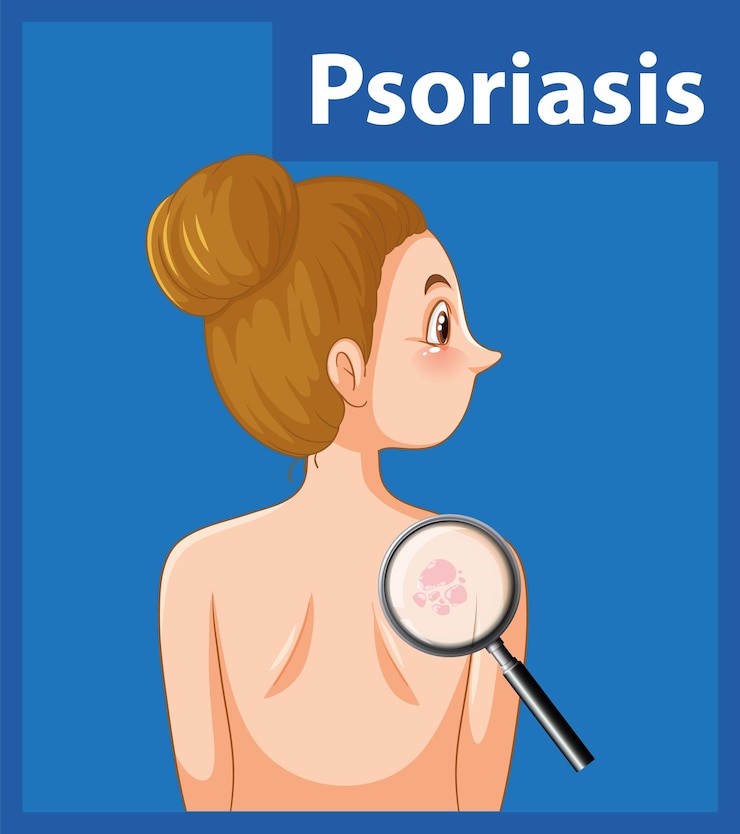Kostenlose Vektor omen mit psoriasis eine cartoon-illustration einer hauterkrankung