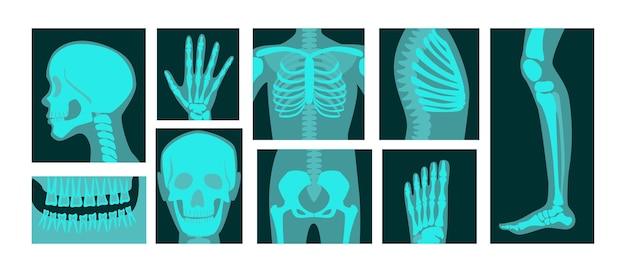 Kostenloser Vektor röntgenaufnahme von menschlichen körperteilen illustrationen set