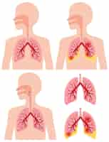 Kostenloser Vektor sammlung von symbolen für die menschliche lunge