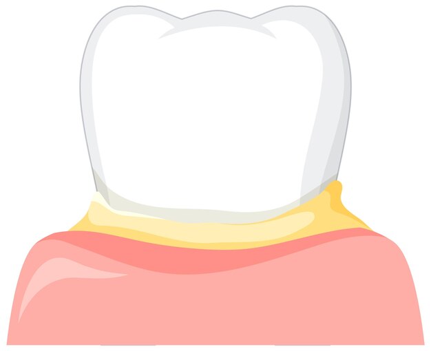 Starker Zahn im Zahnfleisch auf weißem Hintergrund