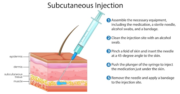 Kostenloser Vektor subkutane injektion mit erklärung