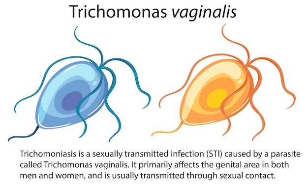 Kostenloser Vektor trichomonas vaginalis mit erklärung