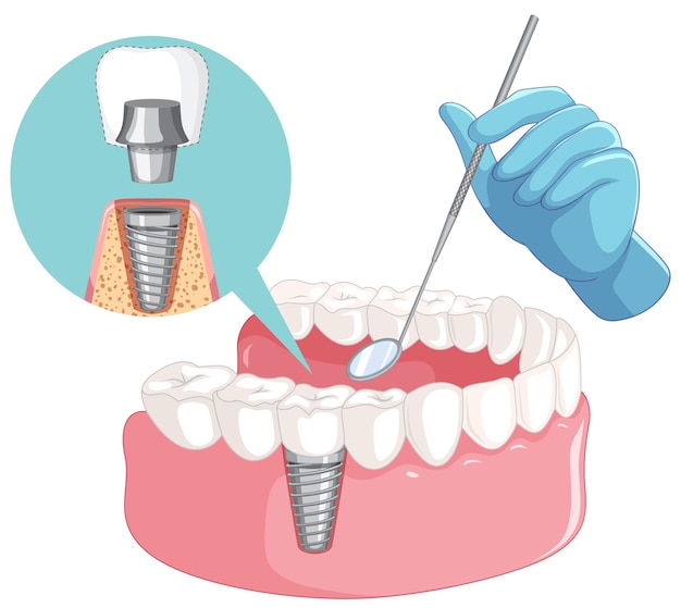 Zahnarzthand mit menschlichem Zahnmodell