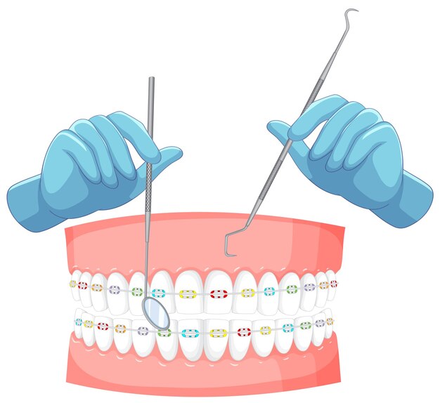 Zahnarzthand mit menschlichem Zahnspangenmodell