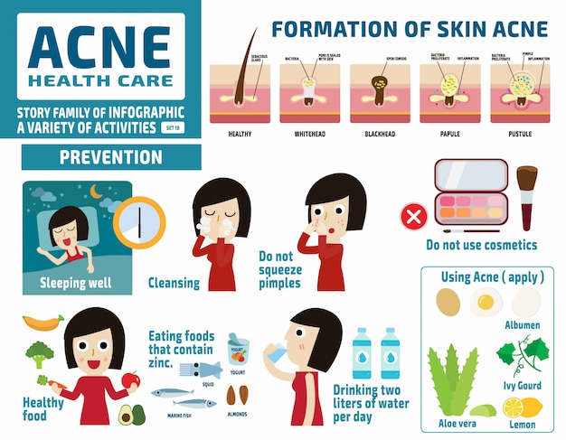 Akne und schützen. gesundheitskonzept. infografik-elemente.