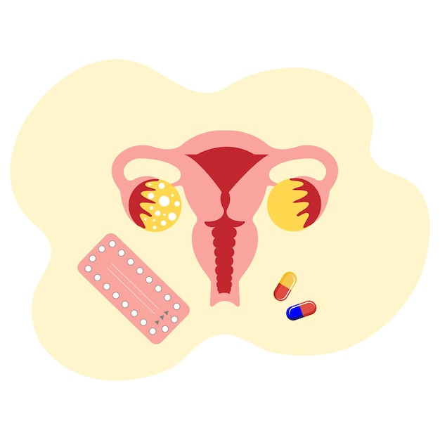 Anatomische zeichnung weiblicher uterus und hormontherapie hormonelle pillen