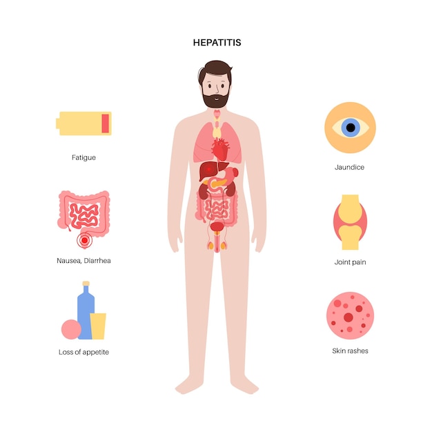 Autoimmunhepatitis