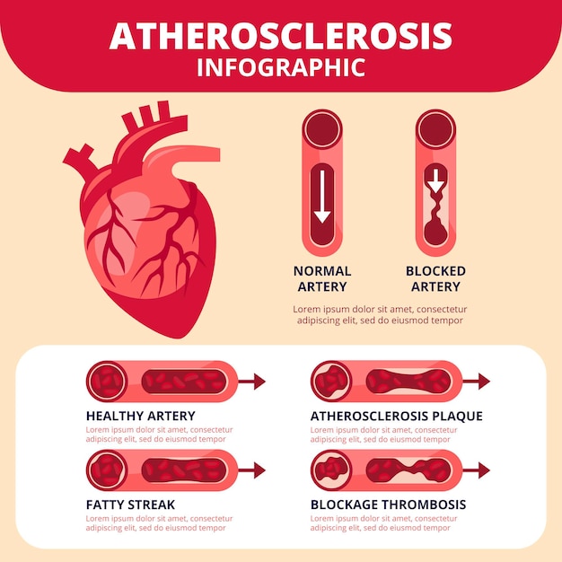 Blut-infografik-konzept im flachen design