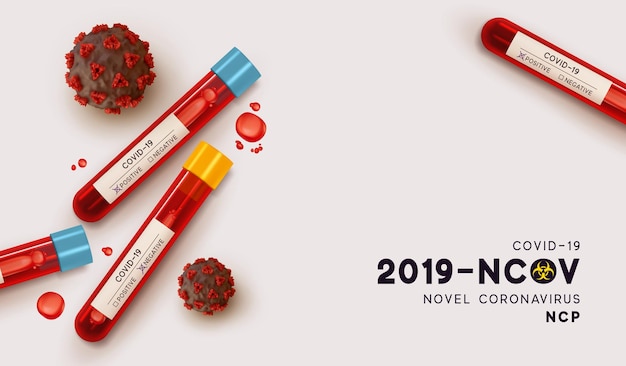 Blutröhrchen zum Testen im Labor auf Coronavirus SARS CoV-2. Bluttest auf Viruserkrankung Covid-19 NCP. Realistisches 3D-Reagenzglas, Ergebnisprobe für Virus positiv-negativ. Vektor-Illustration