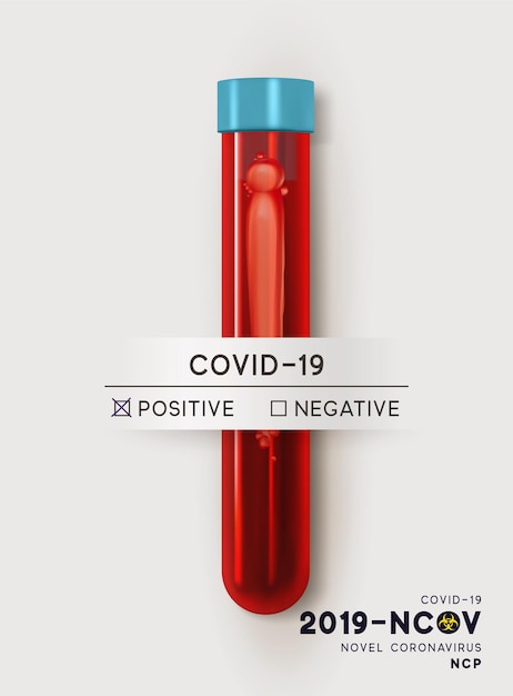 Blutröhrchen zum Testen im Labor auf Coronavirus SARS CoV-2. Bluttest auf Viruserkrankung Covid-19 NCP. Realistisches 3D-Reagenzglas, Ergebnisprobe für Virus positiv-negativ. Vektor-Illustration