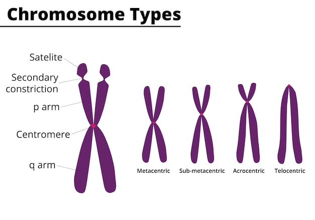 Chromosomenteile Chromosomentyp der entsprechenden Position des Zentromers Vektordidaktische Illustration