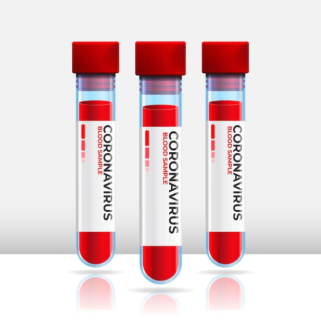 Coronavirus-Bluttest in Röhrchen