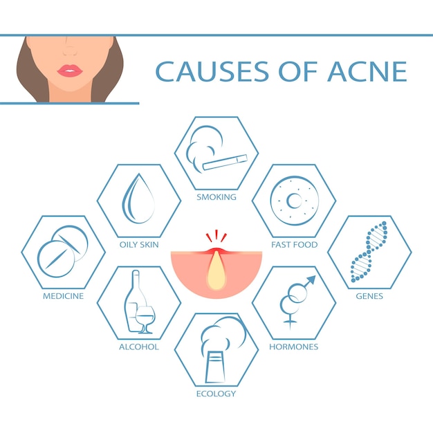 Dermatologie hautprobleme komedonenakne