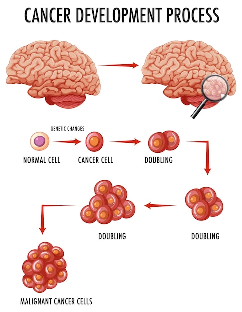 Diagramm, das den krebsentwicklungsprozess zeigt