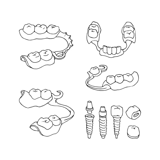 Ein satz zahnersatz. titanimplantate mit kronen. in schwarzer tinte.