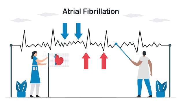 EKG-Signal von Vorhofflimmern. Ärzte untersuchen und analysieren eine Herzerkrankung. Kardiologie-Vektor-Illustration.
