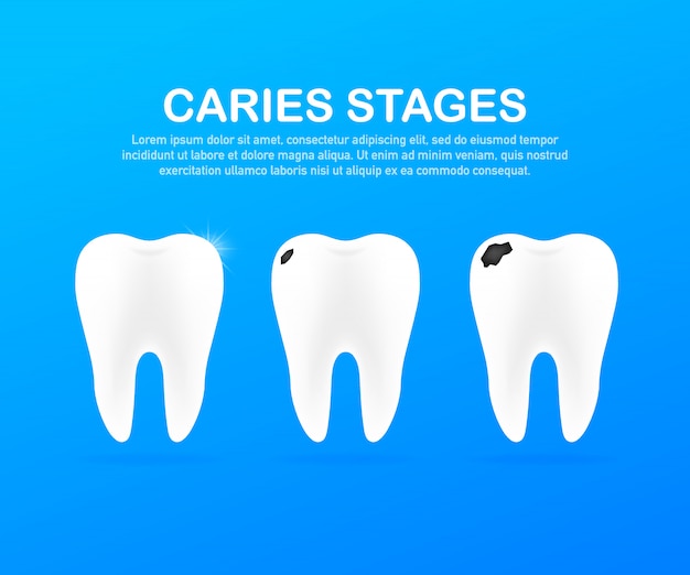 Entwicklungsstadium von karies. zahnpflegekonzept. gesunde zähne.