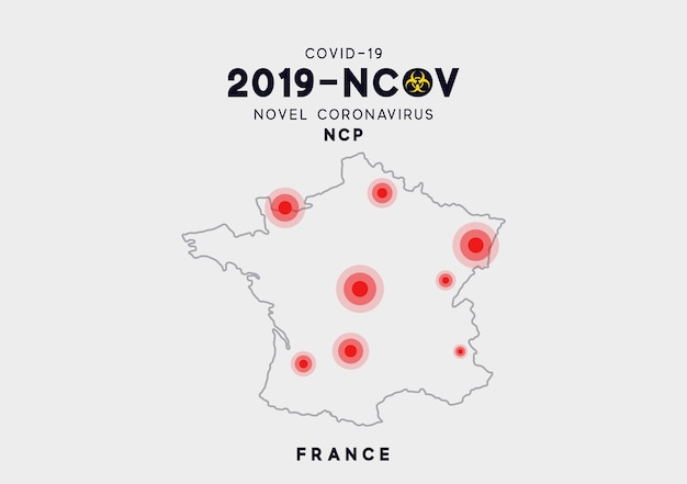 Frankreich karte infografiken, lokalisierung des ausbruchs von virus covid 19. novel coronavirus (2019-ncov). china-erreger des respiratorischen coronavirus 2019-ncov. als ncov wird ein einzelsträngiges rna-virus bezeichnet.