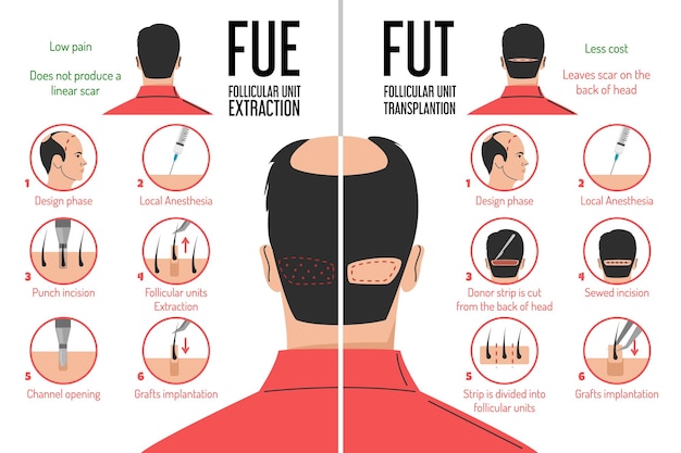 FUT- und FUE-Haartransplantationsprozess