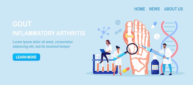 Gichtbehandlung. arthritis-gelenk im sprunggelenk. der arzt diagnostiziert ein geschwollenes und entzündetes fußgelenk. arzt untersucht menschliche fußknochen mit harnsäurekristallen. arzttermin und prüfung