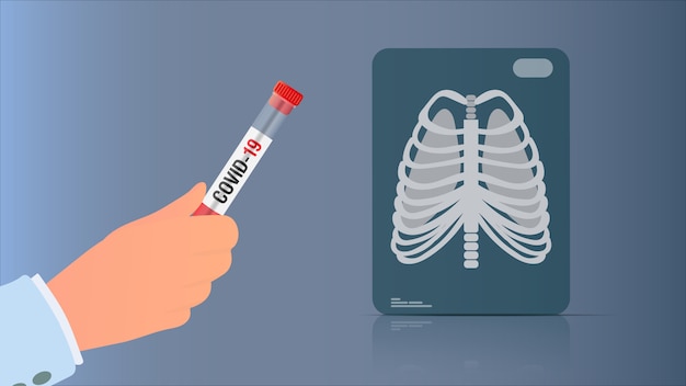 Hand hält test von coronavirus. röntgen der lunge. reagenzglas mit coronavirus-test. illustration.