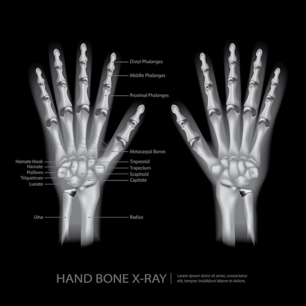 Vektor handknochen-röntgenstrahl-vektor-illustration