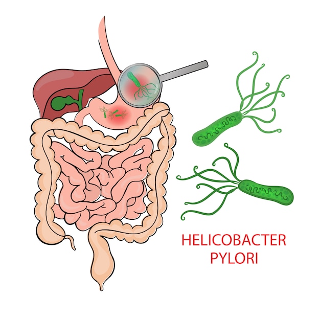 HELICOBACTER PYLORI Medizinische Ausbildung