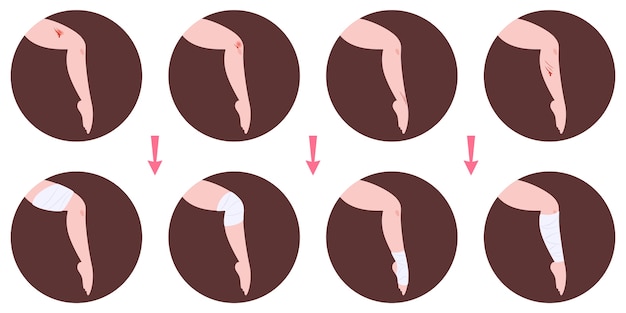 Infografiken zur behandlung von wunden und zur anwendung von verbänden. erste hilfe