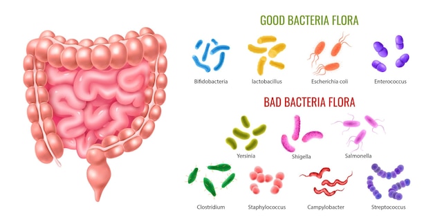 Infografiken zur guten und schlechten Bakterienflora des Dickdarms