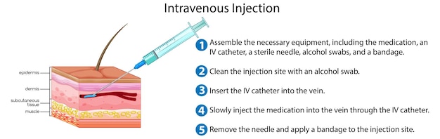 Intravenöse Injektion mit Erklärung