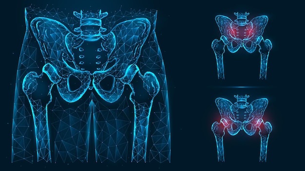 Knochen des Beckens und der Hüfte, menschliche Anatomie. Schmerzen im Becken- und Hüftgelenk.