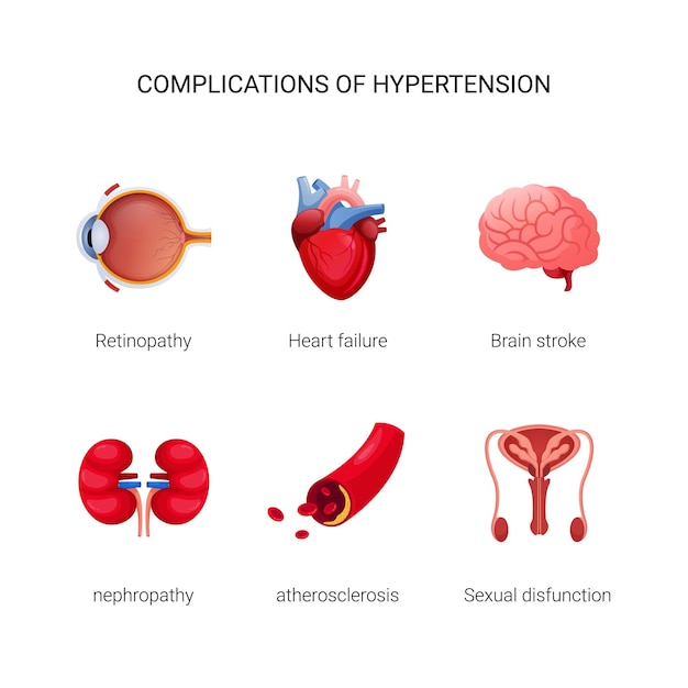 Komplikationen der hypertonie-illustration