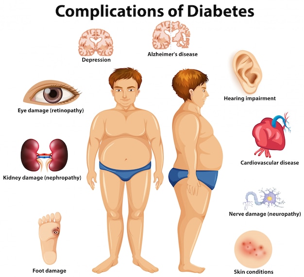 Komplikationen des diabetes-konzeptes