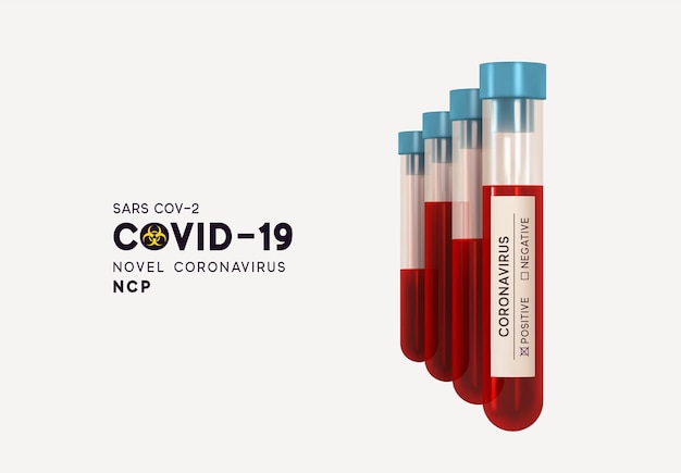 Laborbluttest für Virus Covid19. Das neuartige Coronavirus (2019-nCoV), das als einzelsträngiges RNA-Virus bezeichnet wird. Covid 19-NCP. Realistisches 3D-Reagenzglas aus Glas. SARS-CoV-2. Vektor-Illustration.