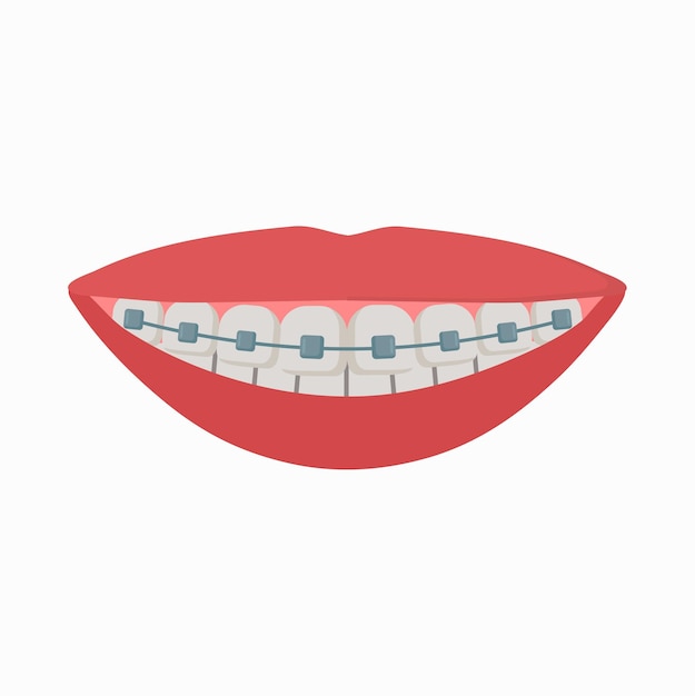 Lächeln mit Klammern Icon Clipart Avatar Logo isolierte Vektor-Illustration