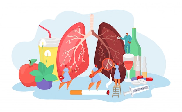 Lungenerkrankung mit ärztlichem medizinischem konzept der diagnose und behandlung von lungenentzündungskrankheiten.