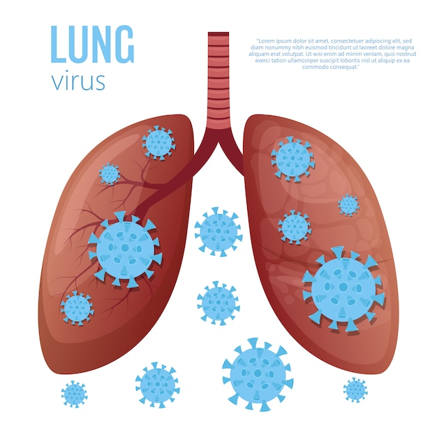 Lungenkrankheitsillustration auf weißem hintergrund