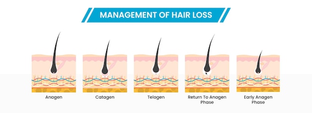Management von haarausfall oder wachstumsphasen infografik-schema-icons im flachen stil