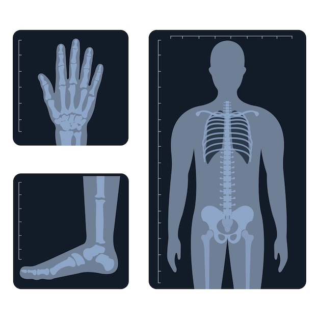 Vektor medizinische radiologie. verschiedene röntgen- oder röntgenbilder von menschlichen körperknochen und -teilen