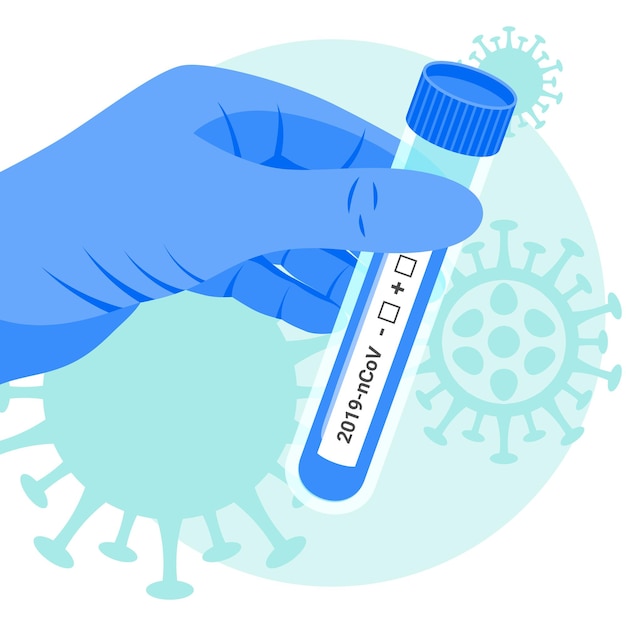 Vektor medizinisches konzept des coronavirus-pcr-tests vektorglasrohrflasche in der hand des arztes 2019ncov-analysen