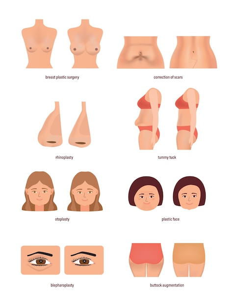 Modernes medizin- und gesundheitskonzept, verschiedene arten der plastischen chirurgie