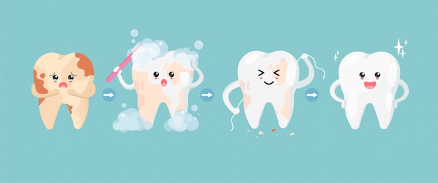 Niedliche Zahnfiguren im flachen Stil. Schritt der Reinigung von Zahnflecken. von ungesunden Zähnen zu gesunden Zähnen.