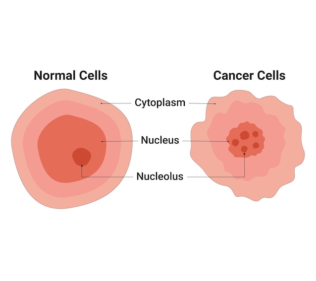 Normale Zellen und Krebszellen-Vektorillustration