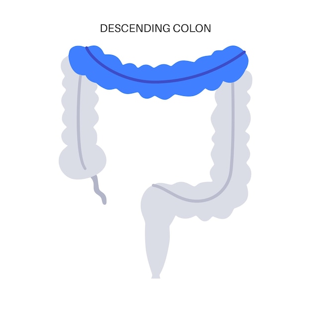 Vektor plakat zum absteigenden dickdarm dickdarm im menschlichen körper diagnostik und behandlung von magen-darm-erkrankungen in der gastroenterologie-klinik verdauungstrakt-untersuchung des darmvektors illustration