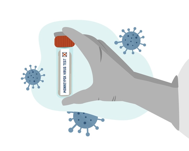Reagenzglas mit positivem test affenpockenvirus konzept behandschuhte hand hält eine infizierte blutprobe viruspartikel vektordarstellung flach