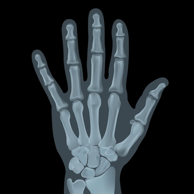 Vektor realistische röntgenaufnahmen. das bild verwendet einen gitterverlauf.