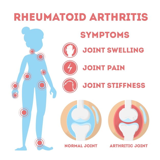 Rheuma infografik. knochenerkrankung zu fuß, hand